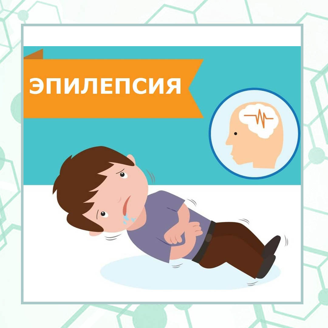 эпилепсия1